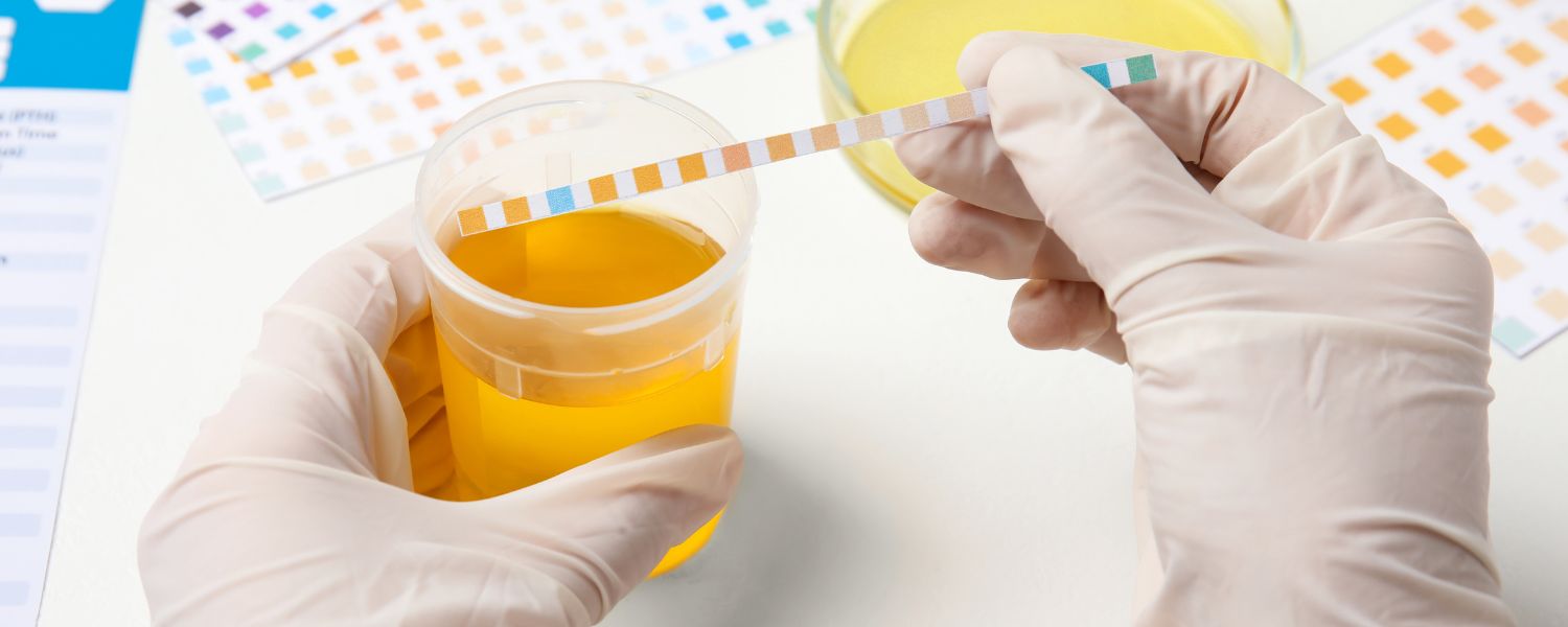 Accurate Results Of Urinalysis Test In Edmond, Oklahoma